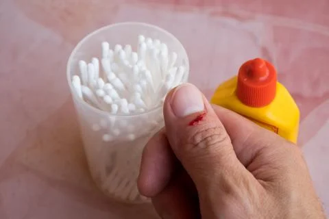 A slight wound in the right thumb is bleeding. Stock Photos