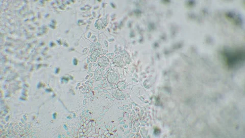 Slime mold amoebas Video stock 312977836