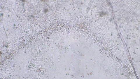 Slime mold amoebas Video stock 312978188