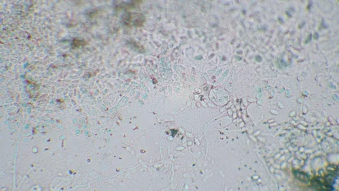 Slime mold amoebas Video stock 312985089