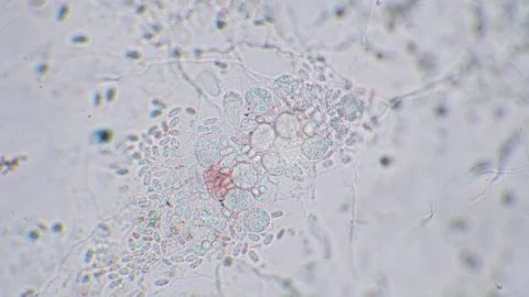 Slime mold amoebas Video stock 312985185