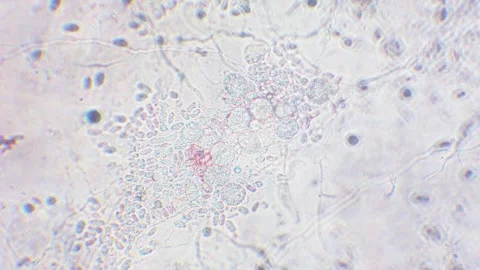 Slime mold amoebas Video stock 312985372