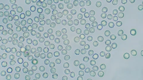 Slime mold spores Stock Footage 312978115
