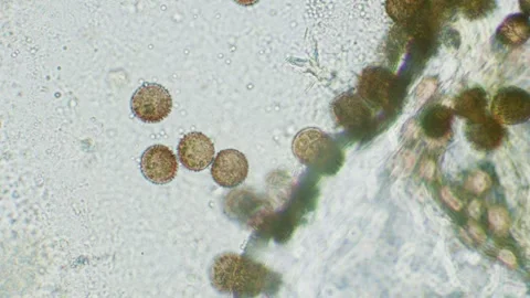Slime mold spores Stock Footage 312978680