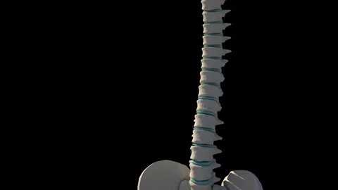 Slipped Disc 動画素材 121125497