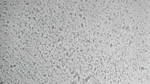 Slow motion active spermatozoa under the microscope. Sperm bank. reproductive fu Stock Footage 232993323