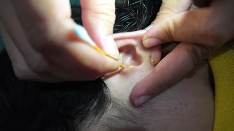 Slow Motion Close-up of Ear Cleaning Using Cotton Swab Under Light Stock Footage 344087508