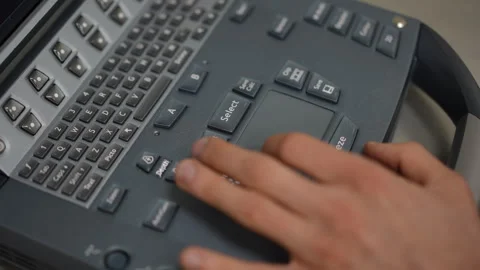 Slow motion. Close-up. A man's hand on the dashboard of the ultrasound machine. Stock Footage 277105629