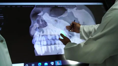 Slow motion of doctors teaching human teeth on vertual screen4 Stock Footage 199272200