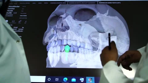 Slow motion of doctors teaching human teeth on vertual screen7 Stock Footage 199272218