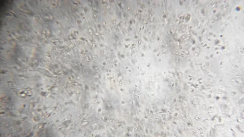 Slow motion filming of the movement of active spermatozoa under a microscope. Sp Stock Footage 232993296