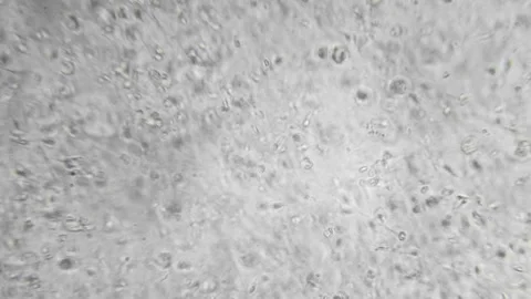Slow motion filming of the movement of active spermatozoa under a microscope Stock Footage 258641567