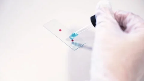 Slow motion: Hand steadily dripping blood out of a pipette onto small Video stock 152862443
