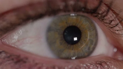 SLOW MOTION MACRO: Green eye irritated by bright sunlight, pupil contracting. Stock Footage 83079913