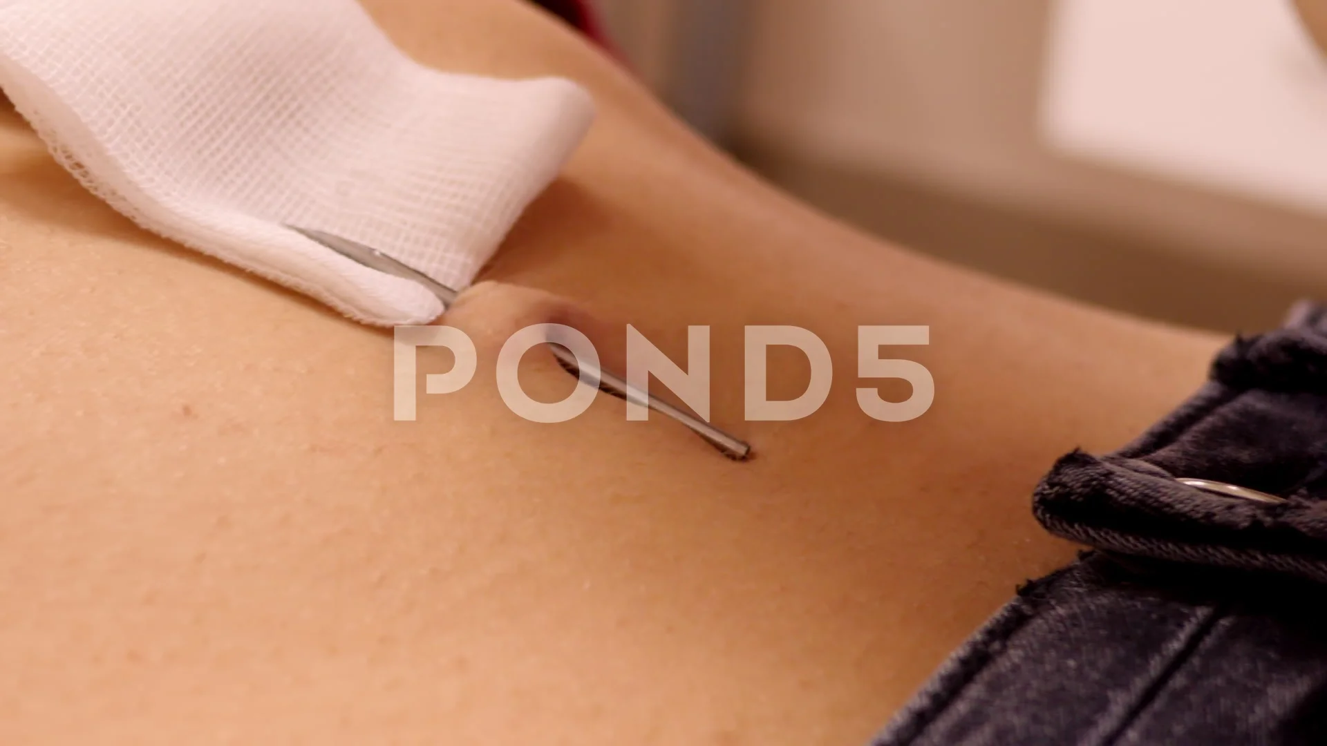 Sale navel needle is stock