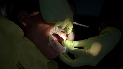 Slow motion vertical shot of a dentist wearing green latex gloves fitting Video stock 255386152