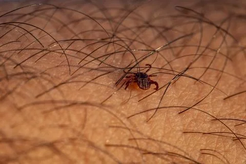 A small brown bug is crawling on a hairy arm 스톡 사진