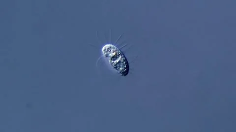 Small ciliophora under microscope view Vídeos de archivo 310314057