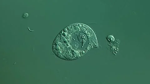 Small ciliophora under microscopy view, pond water sample Vídeos de archivo 306588667