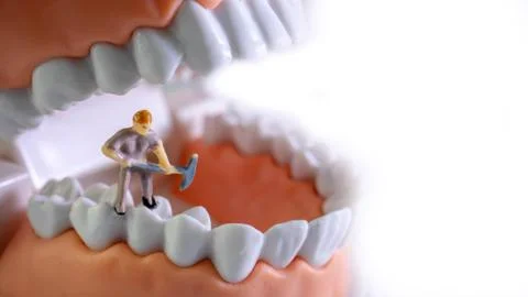 Small figure worker cleaning tooth model as medical and healthcare concept, R Foto stock