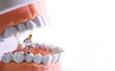 Small figure worker cleaning tooth model as medical and healthcare concept, R Foto stock