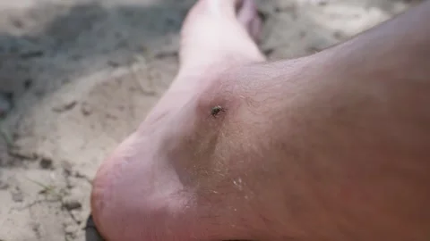Small Fly Landing on Bare Ankle Outdoor During Summer Camping Trip 스톡 동영상 342766105