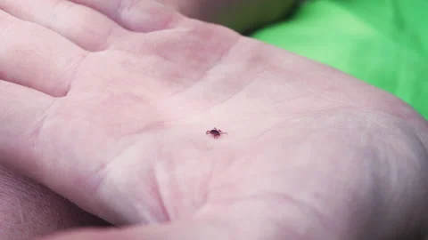 Small Insect Parasite Mite Crawls On a Man's Palm Hand. Tick on the Skin Close Video stock 155107747