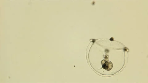 Small Medusa under a microscope, class Hydrozoa, type Cnidaria, size about 1mm. Video stock 116654536