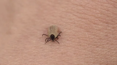 A small mite Stock Footage 81801565