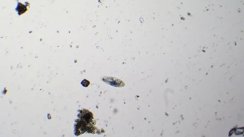Small paramecium at microscope Stock Footage 87807526