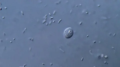 Small parasite and bacteria under microscope, 1000x 動画素材 317140190