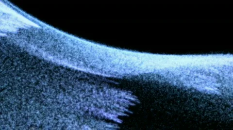 Small particle circle Stock Footage 449537