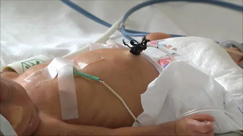 Small patient Stock-Footage 2360204