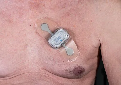 Small portable ECG heart function monitor attached to senior chest Stock Photos
