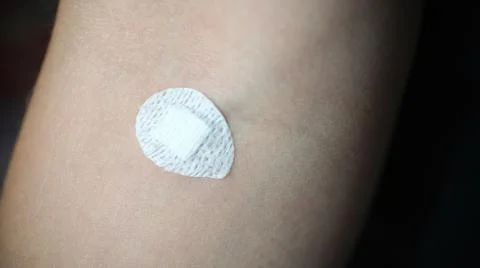 Small round patch stuck in place intravenous injection on forearm closeup Stock Photos