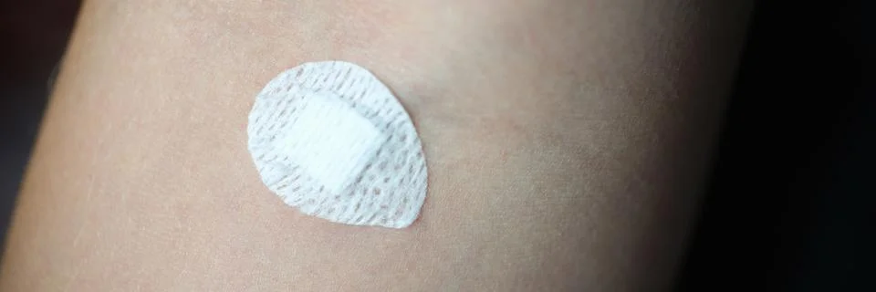 Small round patch stuck in place intravenous injection on forearm closeup Stock Photos