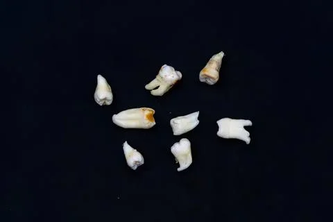 Small teeth scattered on black background Stock Photos