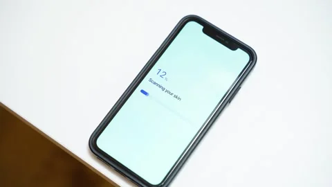 Smartphone on table showing skin scanning progress and dermatologist alert on Stock Footage 341078408