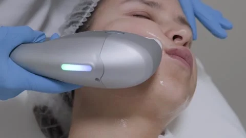 Smas lifting anti-aging therapy. Stockbeeldmateriaal 247380997