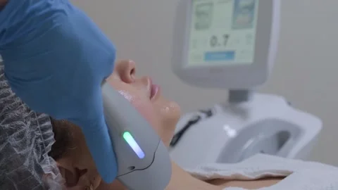 Smas lifting anti-aging therapy. Beautiful female patient face skin, close-up. Vidéo 248336305
