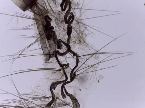 Smashed Mosquito Larva Internal Organs Microscope Extreme Cl Stock Photos