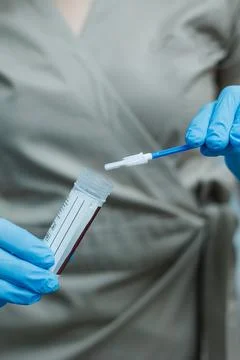 Smear for virus detection. Taking analysis with a smear. Nurse's hands close- Foto stock