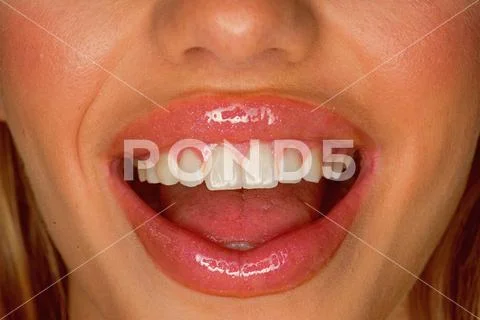 Smile broadly. Dental care. Sexy lips of sexi woman. Sexy woman with white smile Stock Photos
