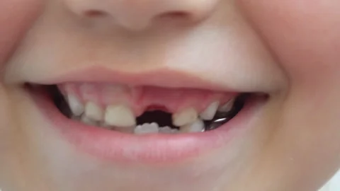 The smile of a child with a lost tooth Video stock 136593083