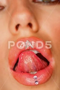 Smile seductively. Silicone injection for lips. Silicone dental braces. Dental Stock Photos