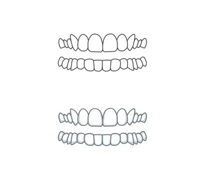 Smile, teeth illustration for dentist. Vector tooth Stock Illustration