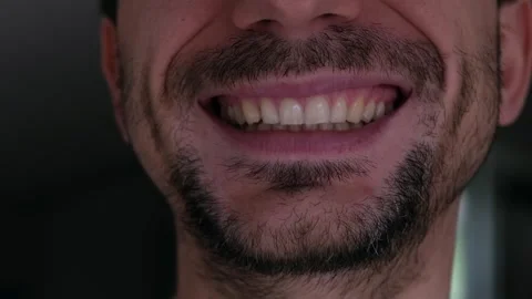 Smiling brunette man in gray clothes with vitiligo skin disease standing at home Stock Footage 273686803