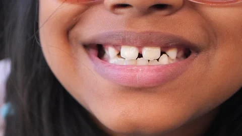 Smiling child showcases missing front teeth during summer fun Stock Footage 303794375