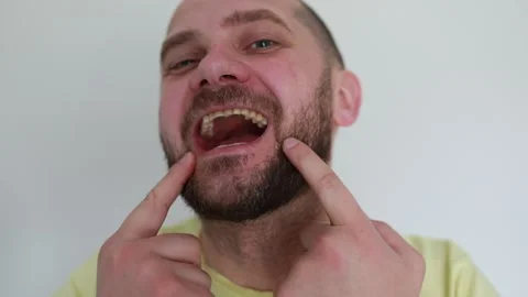 Smiling Man Showing His Missing Tooth in a Bright Indoor Setting Stock Footage 273294030