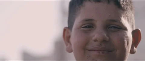 Smiling refugee child. Wounded face immigrant kids Video stock 104732981